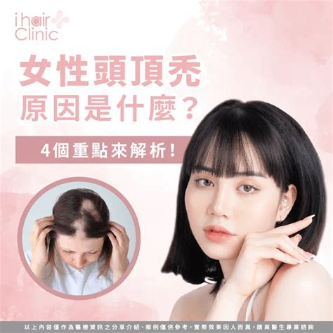 女性頭頂禿原因是什麼4個重點來解析 Ihair風華御髮