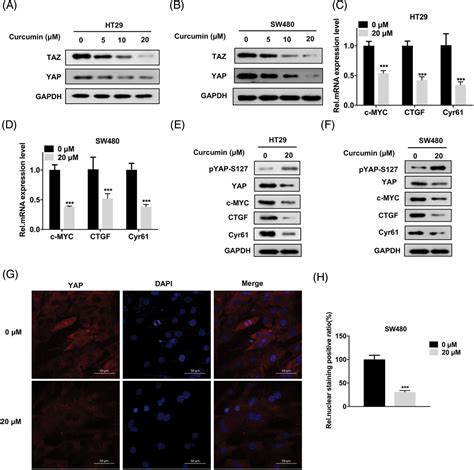 BIOCELL Free Full Text Curcumin Inhibits Colorectal Cancer