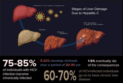 Hepatitis C: Cure Is About More Than the Liver