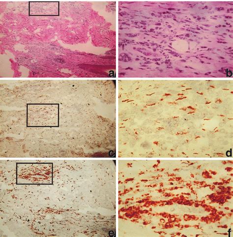 Immunohistochemical Staining Of Skin Biopsies From Infected Naive