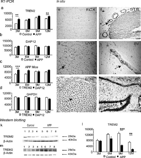 Trem Protein Level Declined With Disease Progression In App Ps Mice