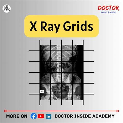 X Ray Tube Protection And Their Importance X Ray Course Chapter 5