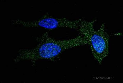 Anti Cdc42 Antibody Ab64533 Abcam