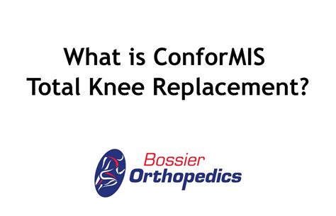 What Is Conformis Total Knee Replacement Youtube