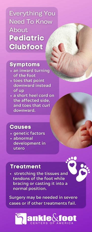 Clubfoot Specialist Nashville Tn Ankle And Foot Centers