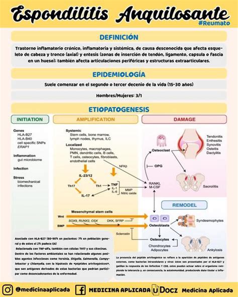 Espondilitis Anquilosante Medicina Aplicada Resumen