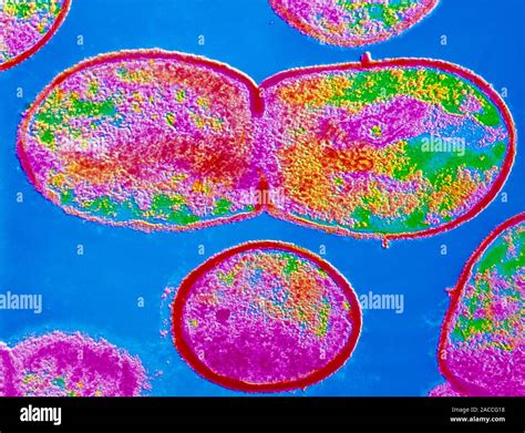 False Colour Transmission Electron Micrograph Tem Of The Gram