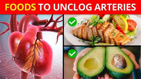 These Foods Unclog Arteries And Can Prevent Heart Attack Youtube