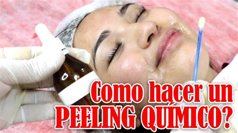 Tutorial De Peeling Qu Mico Acido Glic Lico Tratamiento Para