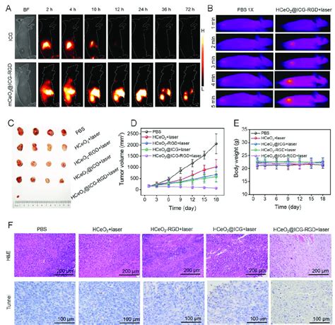 A NIR II Fluorescent Images Of 4T1 Breast Tumor Bearing Nude Mice