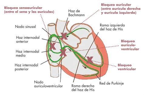 Actividad del nervio vago y el cáncer la neuroinmunomodulación