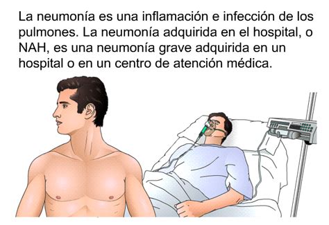 PatEdu Neumonía adquirida en el hospital NAH