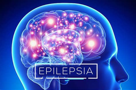 Epilepsia RefratÁria E O Tratamento Com A Maconha Medicinal Ibca