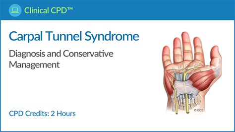 2 Hours Carpal Tunnel Syndrome Diagnosis And Conservative