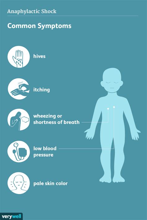 Anaphylaxis Signs Symptoms And Complications