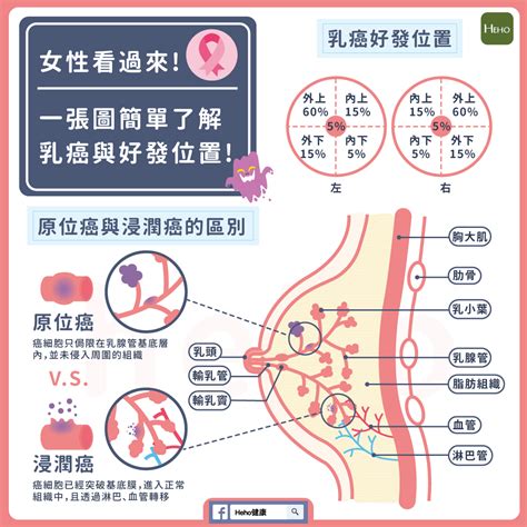 女性看過來！一張圖簡單了解乳癌與好發位置 Heho親子