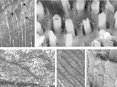 A Dentin Processes Transverse The Whole Primary Dentin Matrix