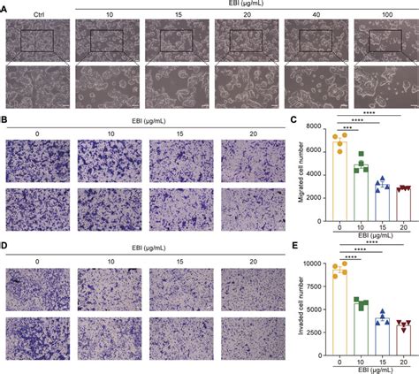 EBI Suppresses Growth Migration And Invasion Of SW620 Cells A