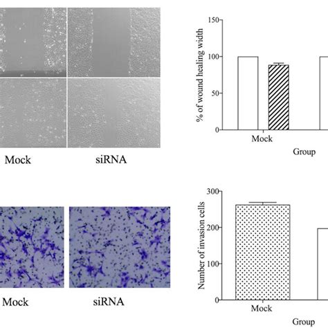 Downregulation Of Mmp Inhibited Cell Migration And Invasion In