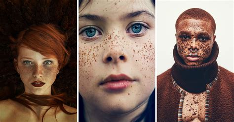 Portraits Magnifiques Qui Prouvent Que Les Taches De Rousseur Sont