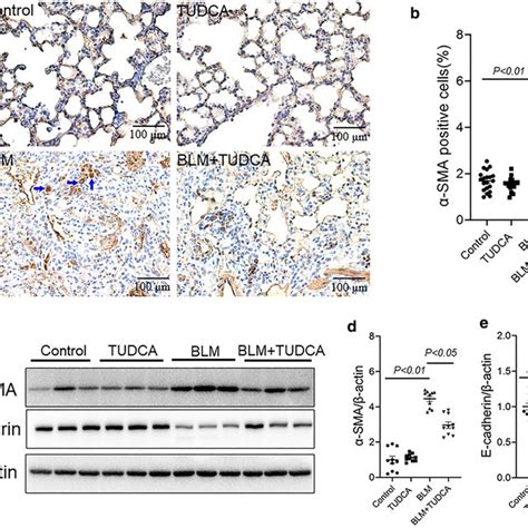 TUDCA Attenuates BLM Induced Oxidative Stress In The Lungs In BLM