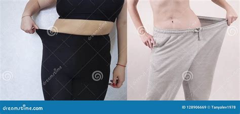 Corpo Do Emagrecimento Da Menina Antes E Depois Da Dieta Imagem De