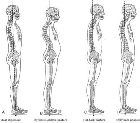 Musculoskeletal Exam 1 Flashcards Quizlet