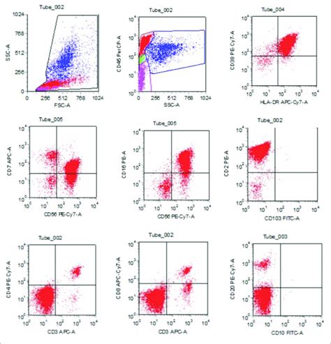 The Flow Cytometry Detection Of Bone Marrow Revealed Cd3 Cd56 Cells