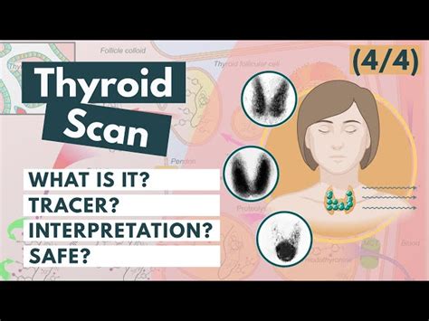 Thyroid Scan A Visual Explanation Schooltube