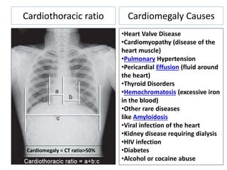 X rays in pediatrics | PPT