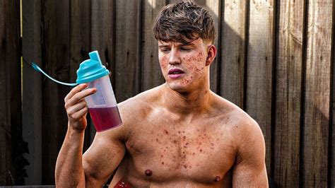 Do Protein Shakes Cause Acne YouTube