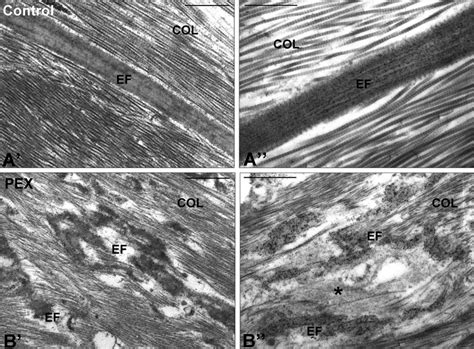 Transmission Electron Micrographs Showing The Ultrastructure And