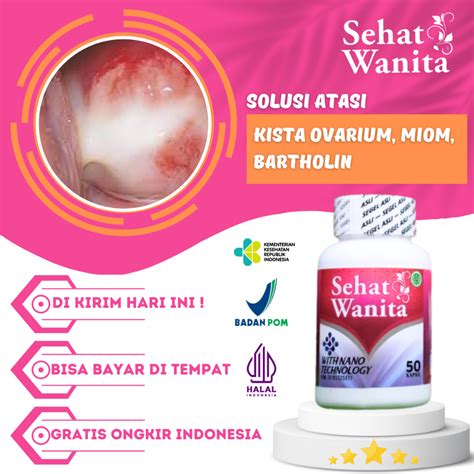 Jual Obat Kista Ovarium Pcos Herbal Kista Miom Bartholin Ganglion Tumor