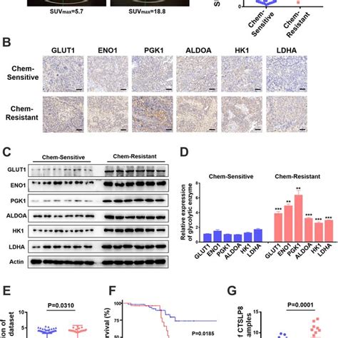 CTSLP8 And The Expression Of Key Glycolytic Enzymes Were Upregulated In