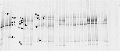 Denaturing Gradient Gel Electrophoresis Fingerprints Of The