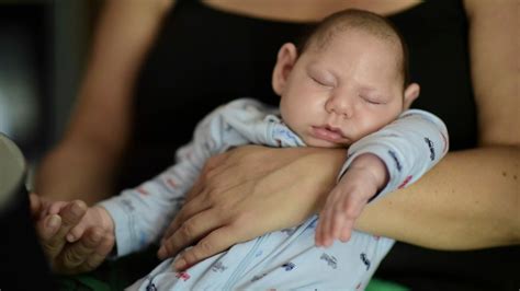 Study In Zika Infected Us Moms Have Babies With Birth Defects