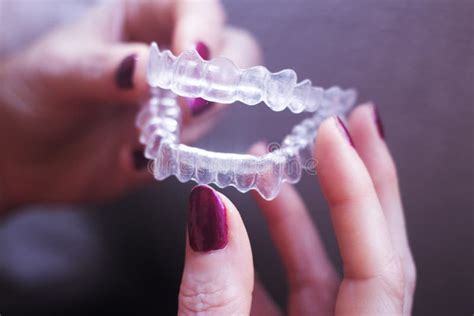 Clear Dental Teeth Retainers Stock Photo - Image of removable ...