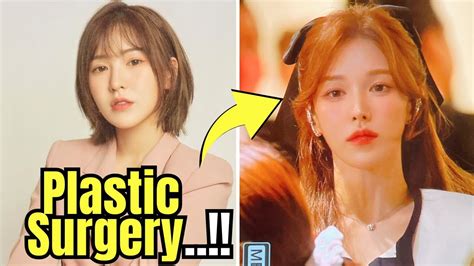 Koreans Defend Red Velvets Wendy Against Trolling Over Plastic