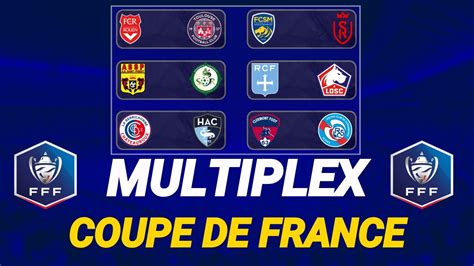 Multiplex Coupe De France En Direct [ Live Talk ] Youtube