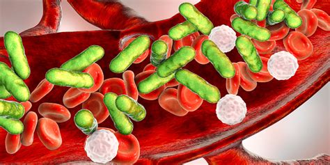 Sepsis Bacteria