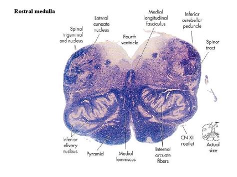 Internal Structure Of Medulla Oblongata By Essam Eldin