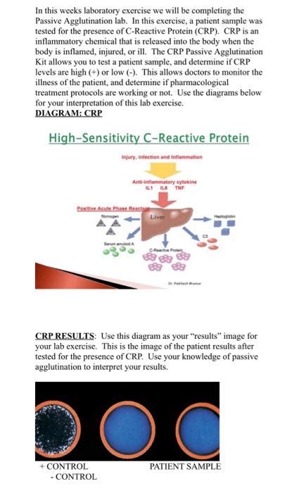 Solved Passive Indirect Agglutination CASE FILE Patient C Chegg