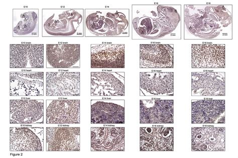 The Differential Spatiotemporal Expression Pattern Of Shelterin Genes