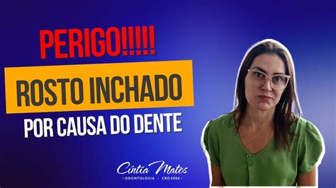 Alerta Rosto Inchado Por Causa Do Dente Perigo O Que Fazer