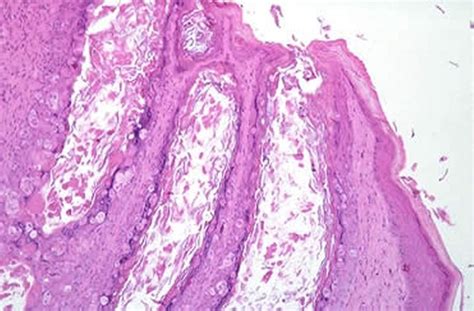 Viral Diseases of Rabbits - Exotic and Laboratory Animals - Merck ...