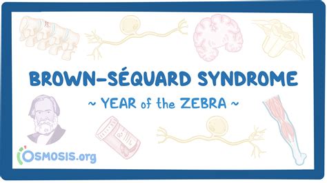 Brown Séquard syndrome Year of the Zebra Vídeo Osmosis