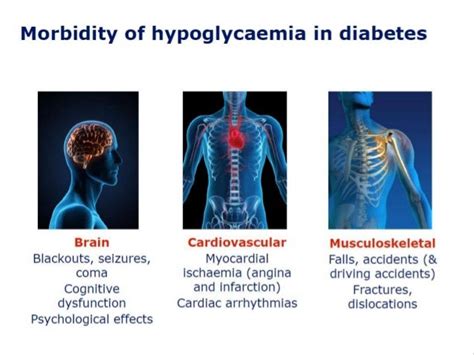 Hypoglycemia Assessment And Treatment