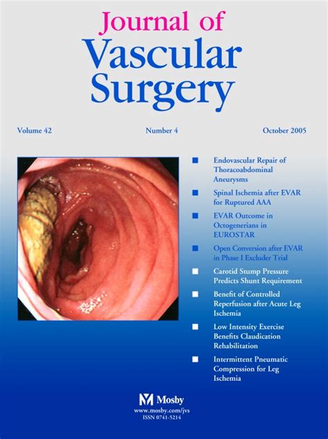 Journal Of Vascular Surgery October 2005 Volume 42 Issue 4 Pages A1 A50 599 828