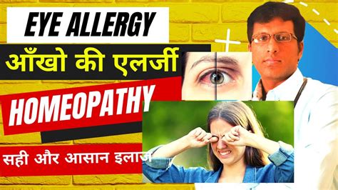 Home Remedies For Eye Allergy Best Treatment For Eye Allergy आँखो की एलर्जी का सही और आसान