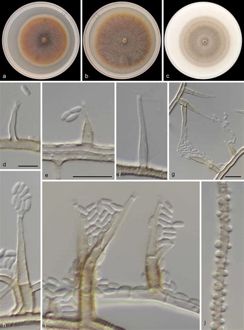 Phaeoacremonium Aureum Cbs 142691 Ex Type Culture Ste U 8372 Csn23